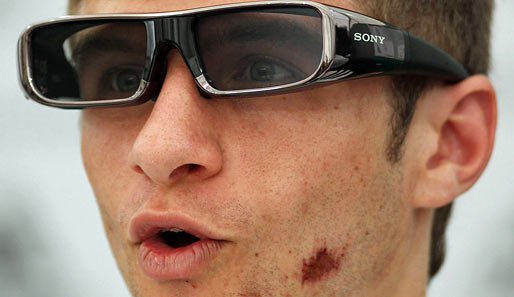 Mit 3D-Brille und Schramme im Gesicht: Im Trainingslager vor der WM in Südafrika stürzt Müller mit dem Mountainbike