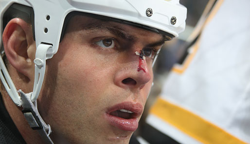 Och wie blutig: Eine deftigst angeknackste Nase bei Nathan Horton von den Boston Bruins. Das ist schon deutlich weniger beschaulich
