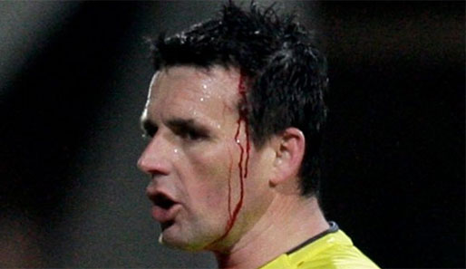 Schiedsrichter Darko Ceferin wurde in Nijmegen von einem Feuerzeug am Kopf getroffen