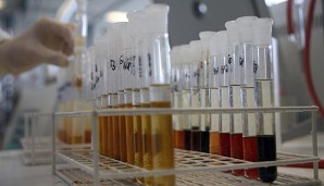In Peking dürfen in den kommenden vier Monaten keine Blut- und Urin-Proben analysiert werden