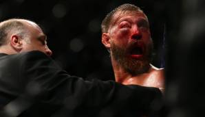 Donald Cerrones Auge schwoll zu, sodass der Ringarzt den Kampf abbrechen musste.