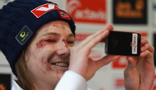 Gesichtsverletzungen und Wirbelbruch: Tom Hilde nach seinem Sturz bei der Vierschanzentournee
