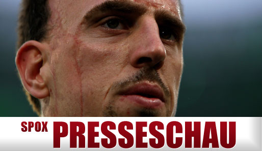 Chelsea und Real Madrid haben angeblich Interesse an ihm: Franck Ribery