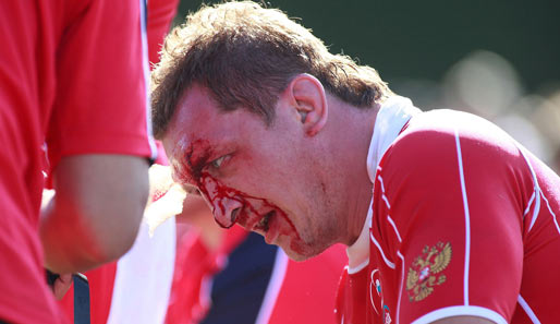 Wenn Russen Rugby spielen, sind solche Bilder wohl keine Seltenheit. Valery Tsnobiladze muss beim Match gegen Neuseeland im Gesicht behandelt werden