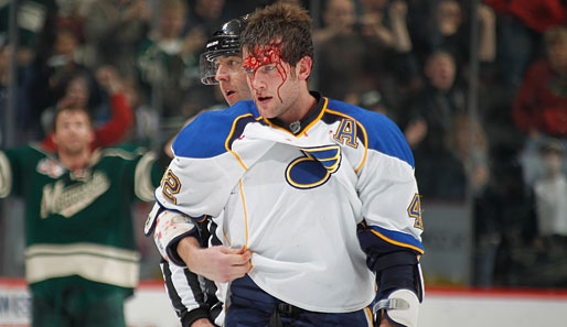 In der NHL wird weiterhin bis aufs Blut um den Puck gekämpft: David Backes von den St. Louis Blues wird morgen wohl Kopfschmerzen haben