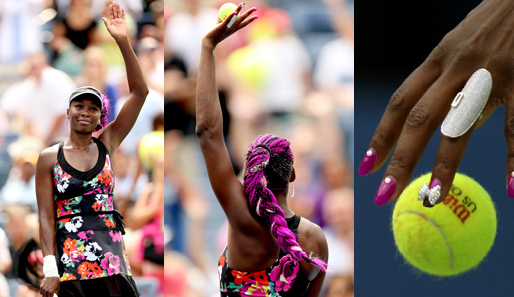 Alles halb so schlimm? Von wegen! Ein Blick auf Venus' Hand spricht Bände. Wie frau damit Tennis spielen kann? Wir wissen es nicht...