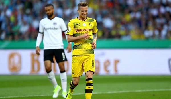 Marco Reus von Borussia Dortmund fehlt wohl länger als gedacht