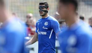 Ozan Kabak könnte dem FC Schalke 04 länger fehlen als ursprünglich gedacht.