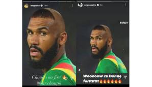 Leroy Sané und Serge Gnabry teilten auf Instagram eine Fotomontage von Eric Maxim Choupo-Moting, die den Kameruner mit der legendären Ronaldo-Frisur von der WM 2002 zeigt.