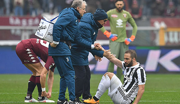 Gonzalo Higuain von Juventus Turin verletzte sich im Spiel gegen Torino nach einem Zusammenprall mit Sirigu.