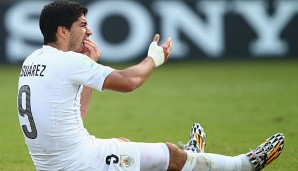Luis Suarez wurde gegen Italien erneut negativ auffällig