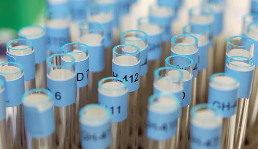 Gegen mindestens 14 Sportler wurde ein Doping-Verfahren eingeleitet
