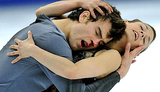 Eric Radford holte sich bei der Eiskunstlauf-WM eine blutige Nase