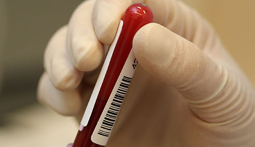 Blut-Manipulationen sind gemäß WADA-Bestimmungen grundsätzlich verboten