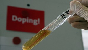 Der Doping-Opfer-Hilfe-Verein greift den DOSB scharf an