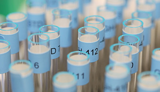 Fortschritt bei der Doping-Nachweisung: Nachweismittel für Epo-Mimetikum Hematide gefunden